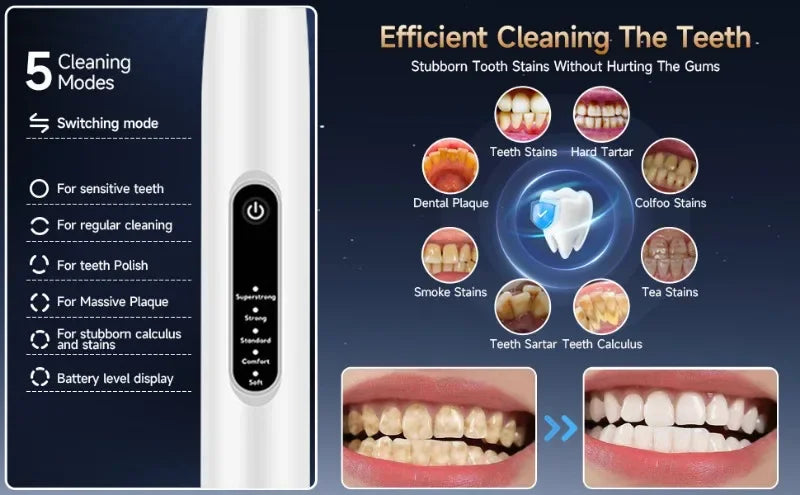 Ultrasonic Electric Pet Teeth Cleaner & Toothbrush